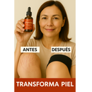 Aceite Corporal Enara™ - Rejuvenezca su piel hasta 15 años